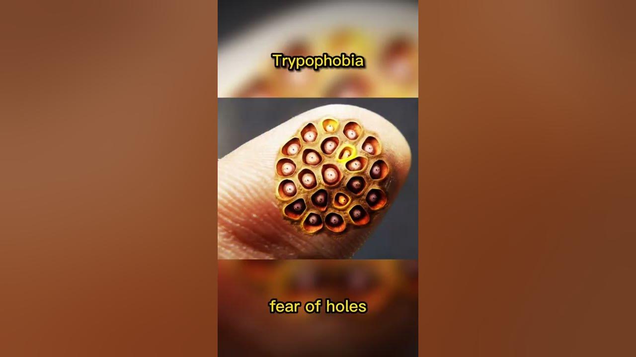 Trypophobia 👹 #shorts #scary #trypophobia