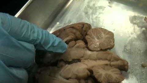 Sheep Brain Dissection Pt. 2