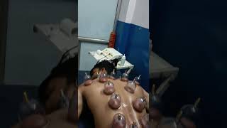 Cupping therapy |Muscle pain |full body massage stiffness cuppinginjaipur