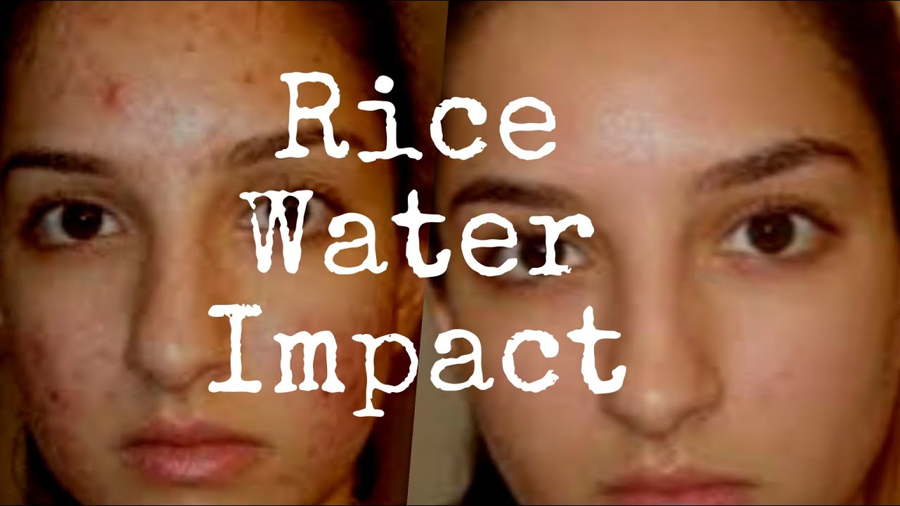I Used Rice Water On My face And This Is What Happened To My Face YouTube