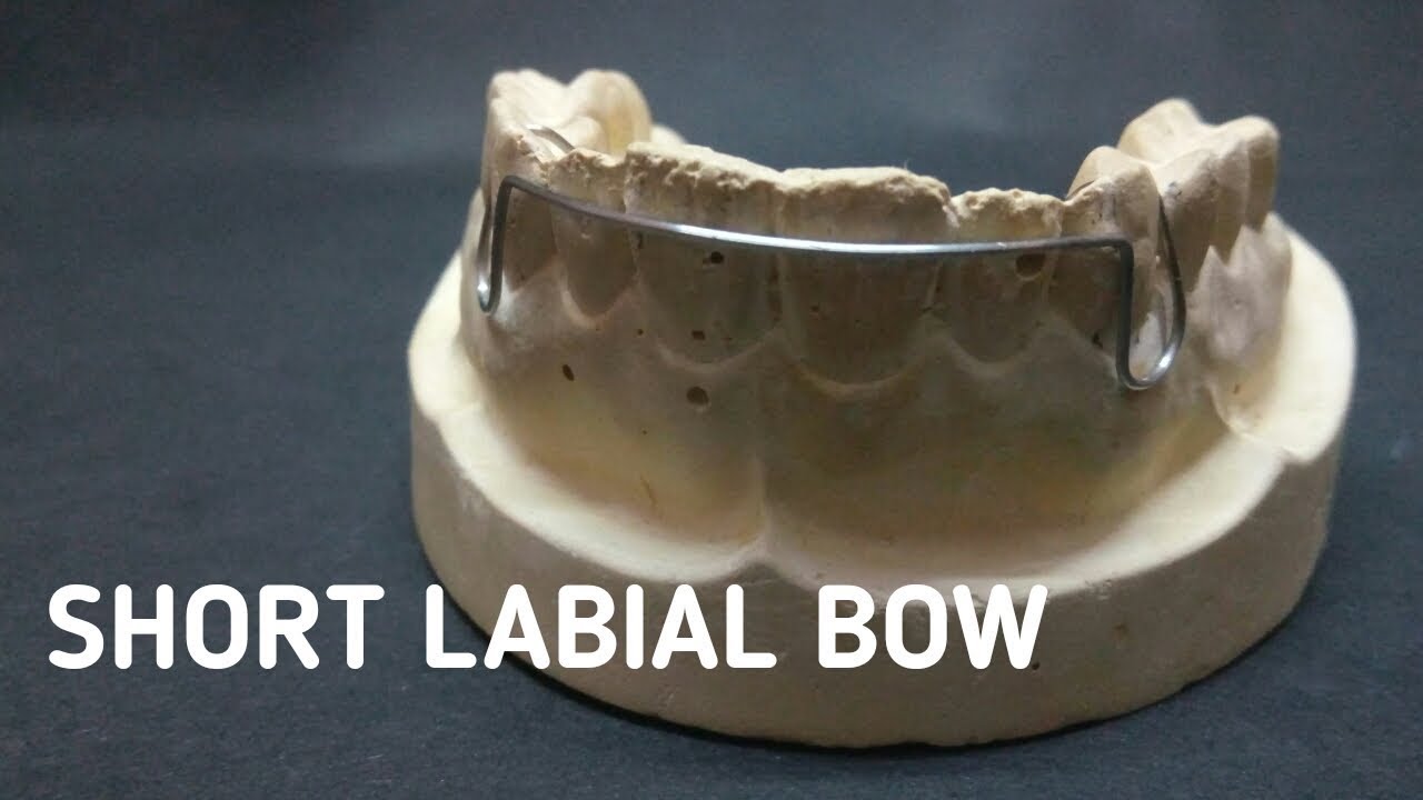 Short labial bow YouTube