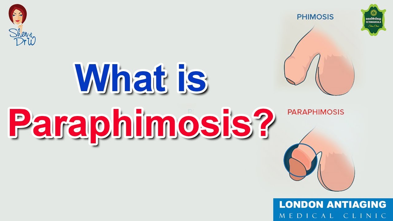 LEXIPatho: Phimosis et Paraphimosis