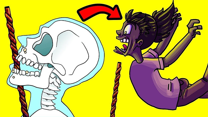Pessoas Sortudas Que Sobreviveram Ao Impossível – Parte 9