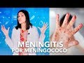 Cómo NO enfermarte de Meningitis | Salud en Corto- Previniendo infecciones