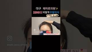✨모발이식 Before &amp; After✨6개월 경과ㅣ헤어로의원 대구점ㅣ