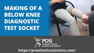 Making of a Below Knee Diagnostic Test Socket | Prosthetic Orthotic Solutions International