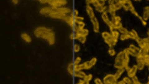 Huygens deconvolution