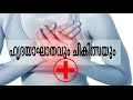 Heart attack treatment :Doctor Live