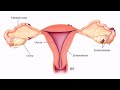 Еднметриоза, ендометрит и миома на матката