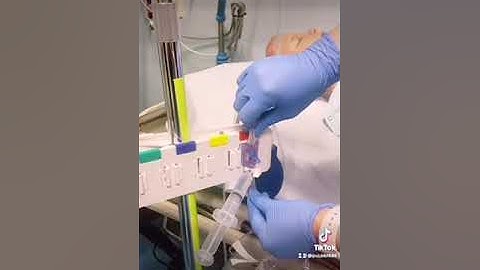 Vamp Jr (Pediatric Arterial Line) Setup [[part I]]