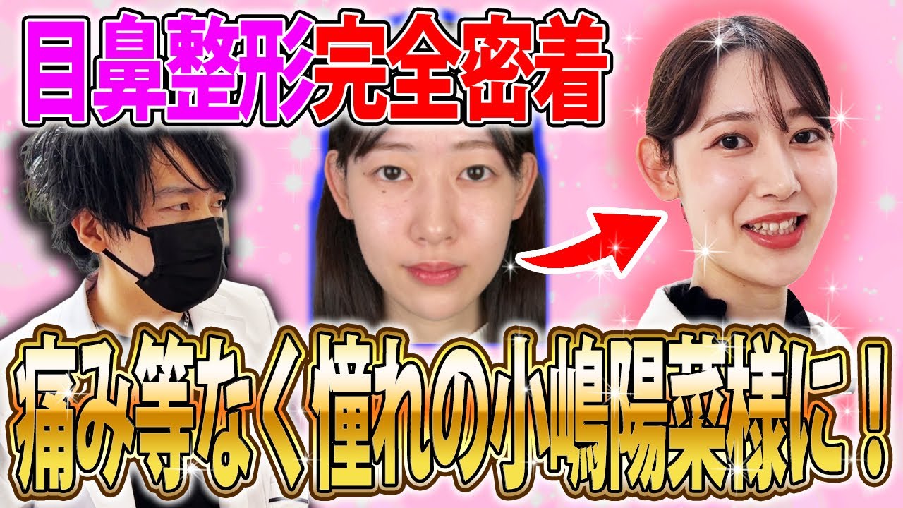 小嶋 陽 菜 整形