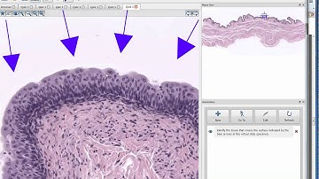 Video Review of Module 1 Part B Quiz