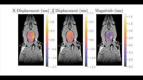MRI Measurement of Displacement in a Rat Brain