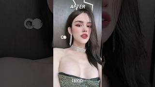 FFS Moments of Change: Revealing Before and After Photos of Plastic Surgery