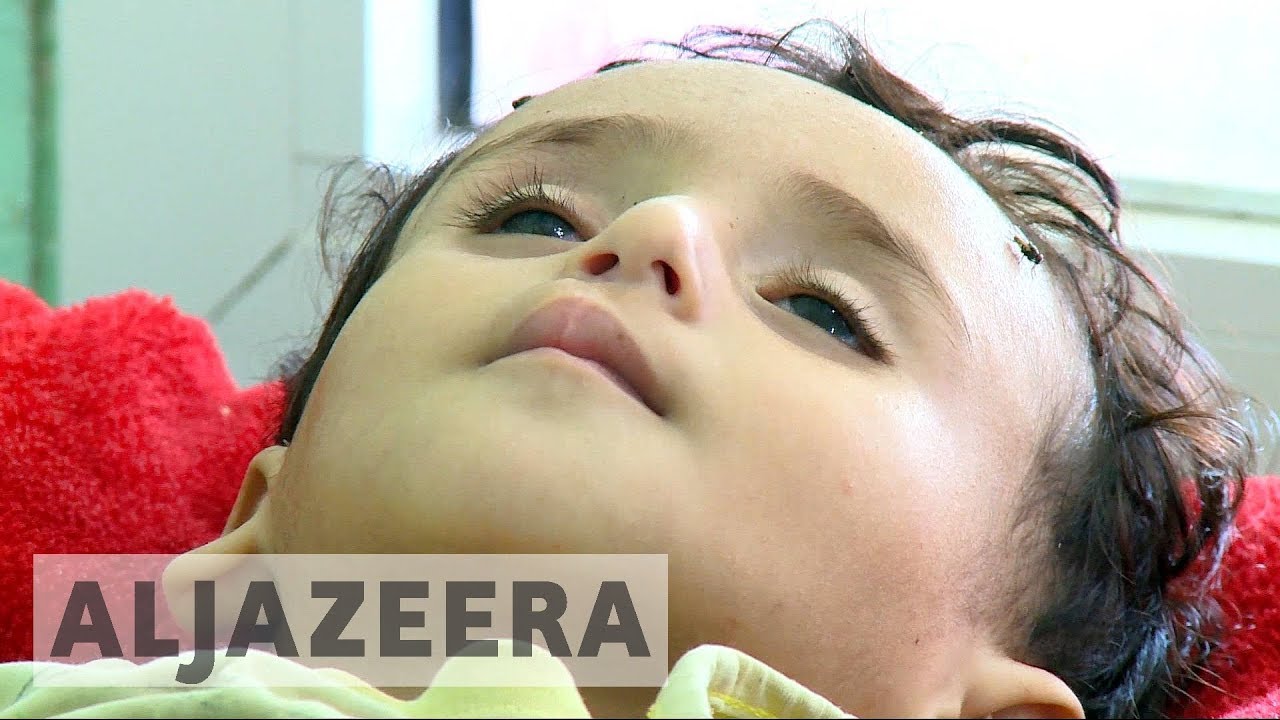 الأمم المتحدة توافق على إرسال محققين في جرائم الحرب إلى اليمن