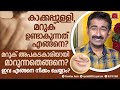 കാക്കപ്പുള്ളിയും മറുകും ഉണ്ടാകുന്നതെങ്ങനെ ? Moles മറുകും കാക്കപ്പുള്ളിയും എങ്ങനെ നീക്കം ചെയ്യാം ?