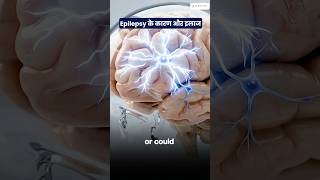 Epilepsy क्यों होती है? कारण, लक्षण और इलाज | What Causes Epilepsy? Symptoms & Best Treatment Option