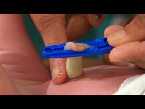 umbilical cord cream for baby