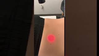 High Intensity Laser Therapy For Low Back Pain
