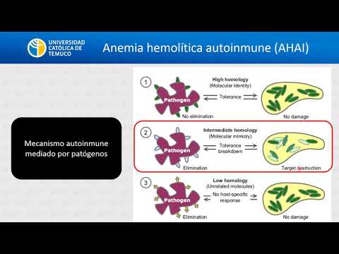 HC: Anemias Hemolíticas Extracorpusculares