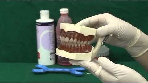 치과에서하는 불소도포