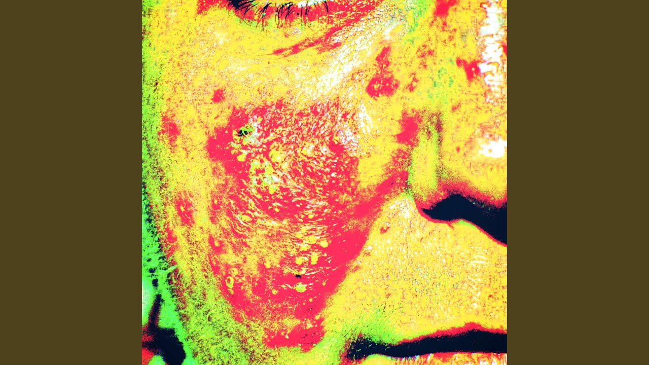 Watch ITCH on YouTube Watch ITCH on YouTube