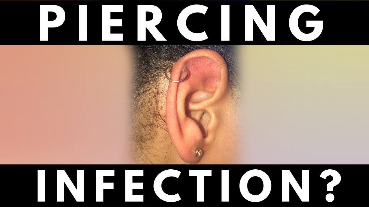 Preventing an Ear Piercing Infection | Ear Problems - YouTube
