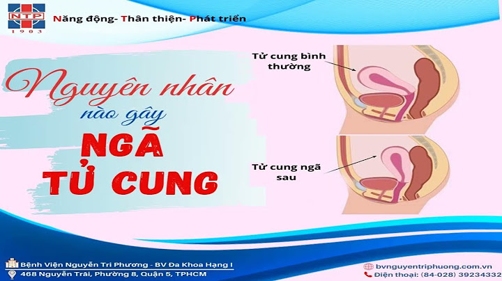 Tử cung ngả trước là gì năm 2024