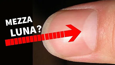 Come togliere simbolo luna Huawei?