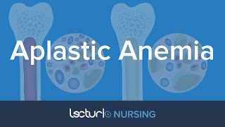 Aplastic Anemia: Causes, Types, and Pathophysiology | Pediatric Nursing | NCLEX Prep