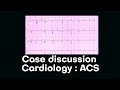 Cardiology case discussion || ACS || Emergency Medicine