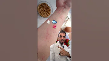 ماهو العامل المشترك لعلاج انواع الحساسية 