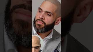 Hollywood Hairline Secret: Are Celebrities Using Scalp Micropigmentation (SMP)?