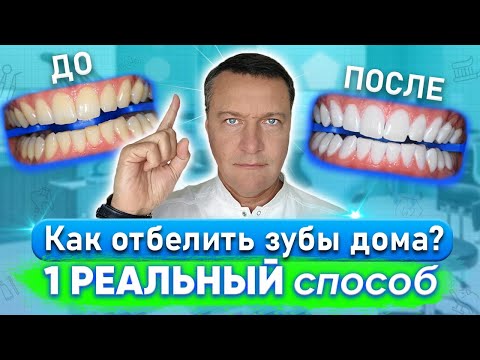 Отбеливание зубов в домашних условиях без вреда для зубов