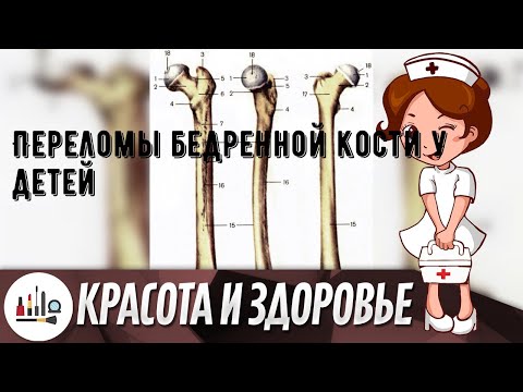 Переломы бедренной кости у детей