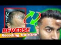 How To Stop/Reverse a Receding Hairline