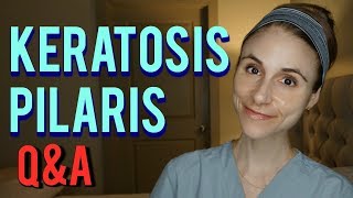 KERATOSIS PILARIS: Q&A WITH A DERMATOLOGIST| Dr Dray