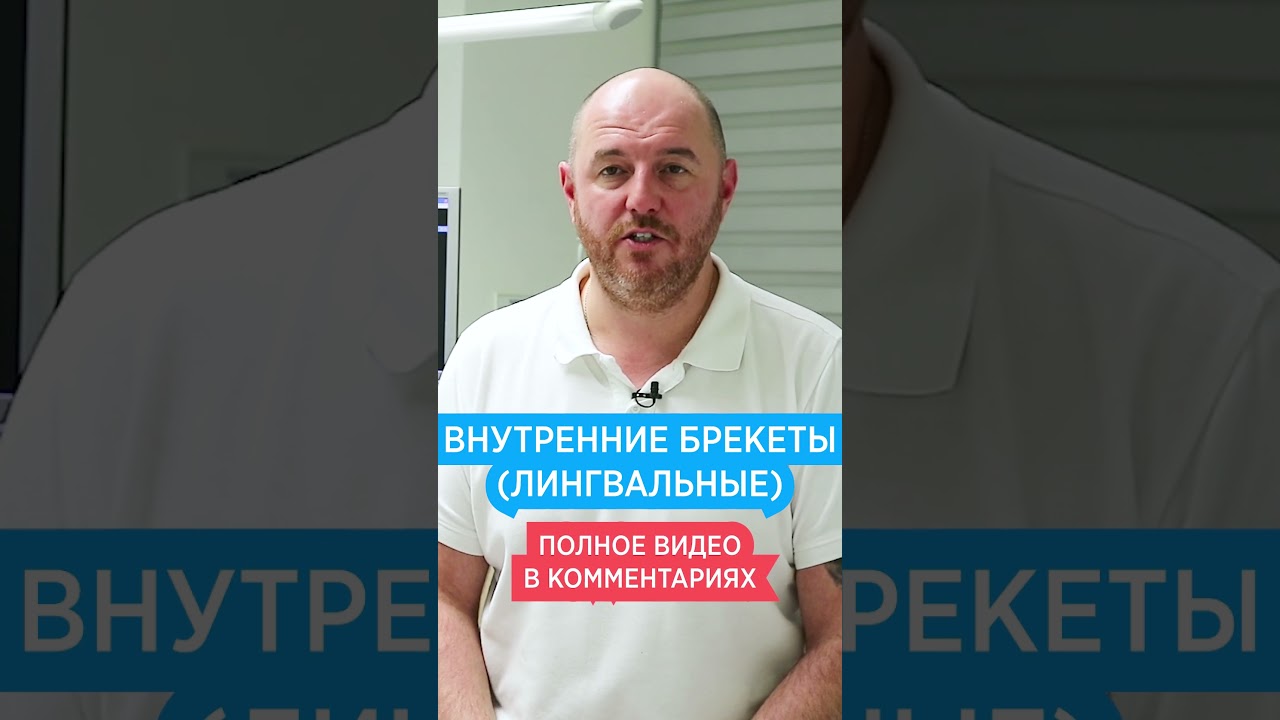 🦷 Внутренние брекеты (лингвальные) 🦷 Плюсы и минусы брекетов