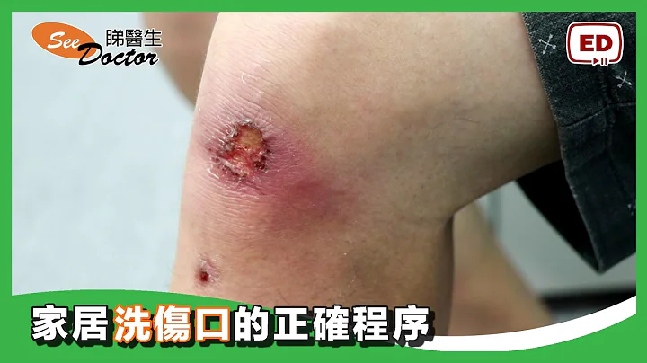 家居洗伤口的正确程序 【 生理盐水  无菌换症包 清洗伤口】 - 天天要闻