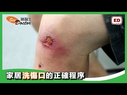 家居洗傷口的正確程序 【 生理鹽水  無菌換症包 清洗傷口】