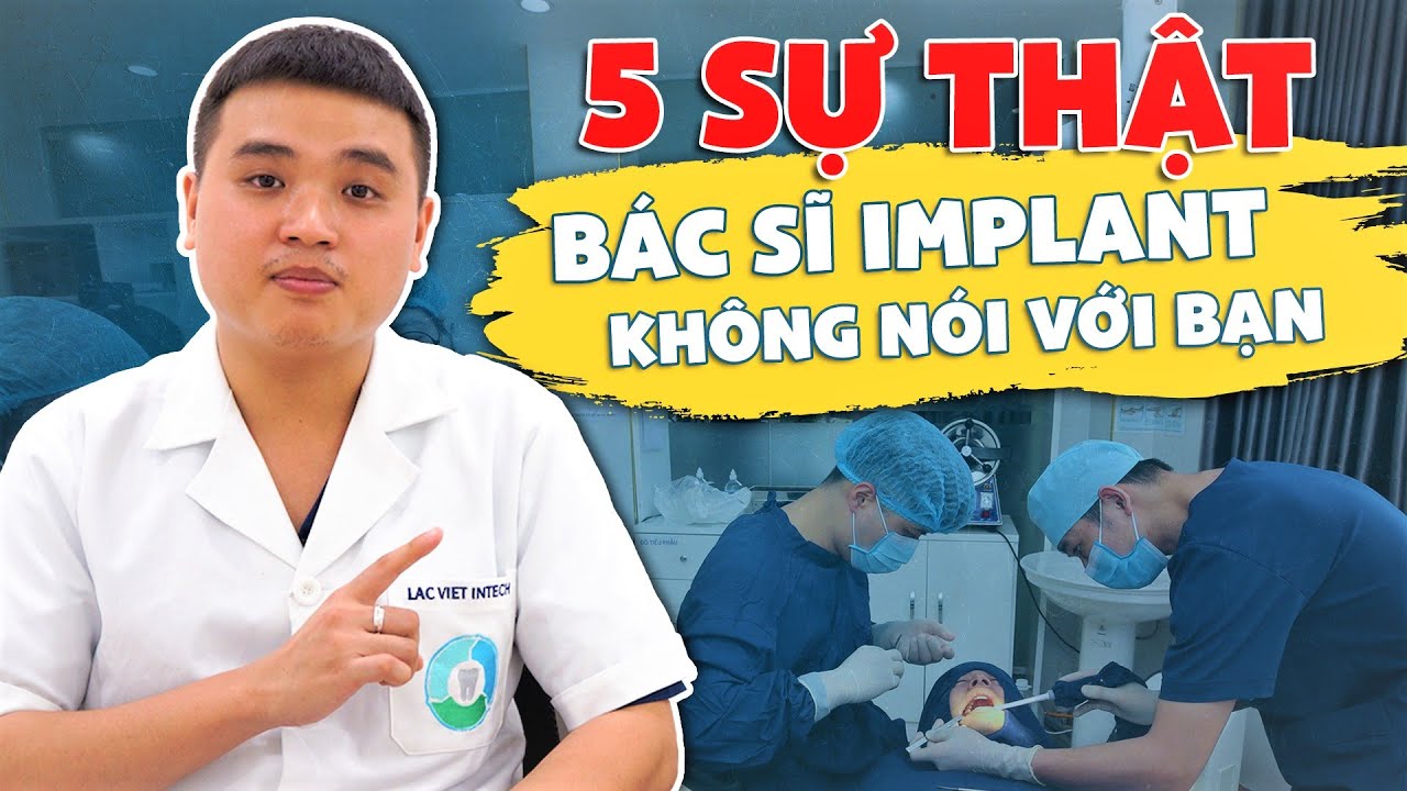 Outline Video 5 SỰ THẬT BÁC SĨ IMPLANT KHÔNG NÓI VỚI BẠN - CẤY GHÉP RĂNG IMPLANT 2022 | NHA KHOA LẠC VIỆT INTECH