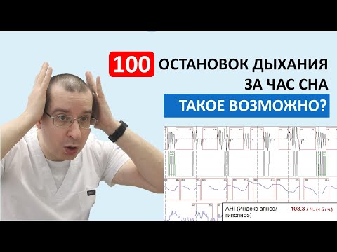 100 ОСТАНОВОК ДЫХАНИЯ В ЧАС! | Разбор реального случая тяжелой формы сонного апноэ