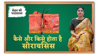 सोरायसिस: कारण, लक्षण, इलाज | Psoriasis: Symptoms, Causes, Types, Treatment | Sehat ki Pathshala