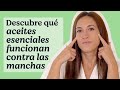 Aceites esenciales para eliminar las manchas  mifarma by atida