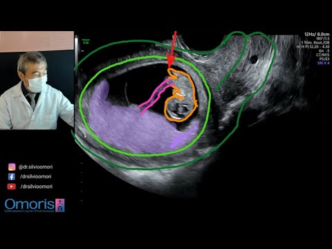 Video: Ku është placenta cotyledonare?