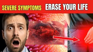 Colon Cancer Symptoms That May Be Silently Killing You