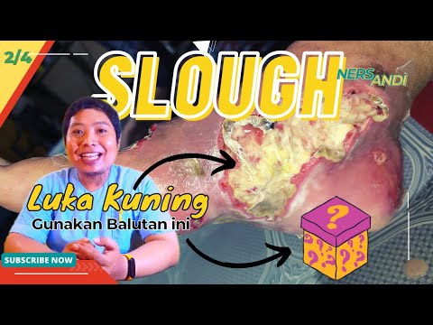 Video: Apa itu slough dalam luka?