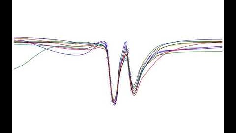 Black-box Stochastic Variational Inference in a Deep Bayesian Neural Network