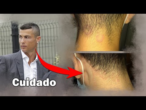 Video: Cómo evitar y curar la picazón después de un corte de pelo: 8 pasos