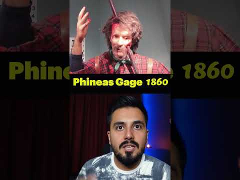 چرا این مرد زنده مونده عجیب